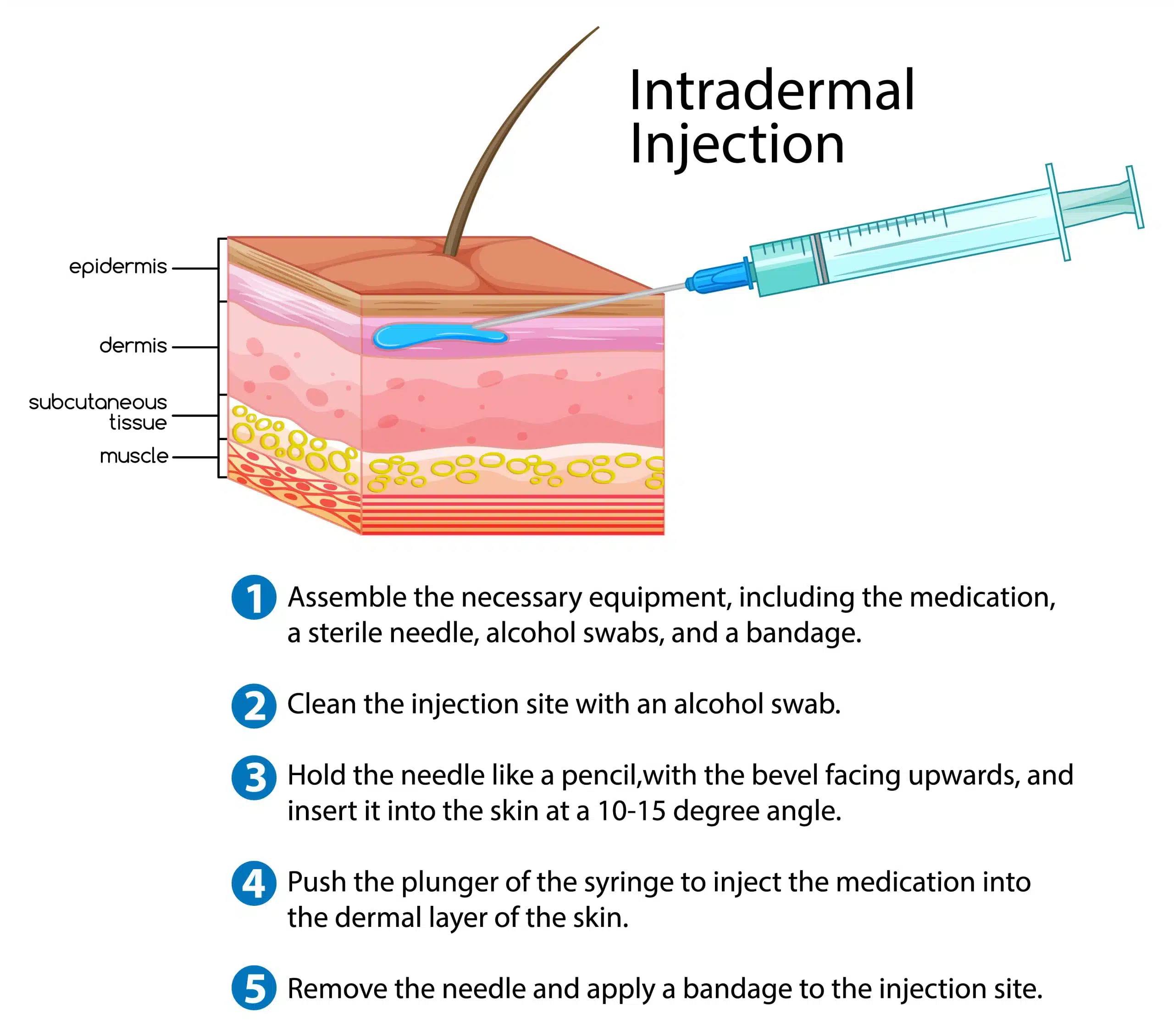 intradermal route of drug administration