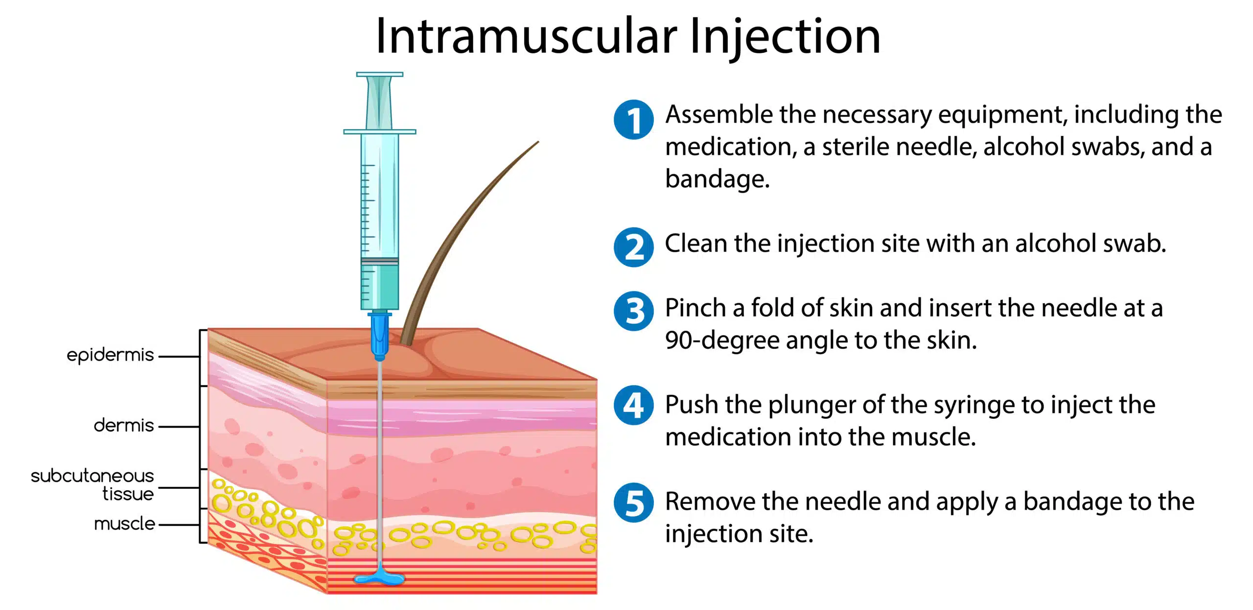 Intramuscular route of drug administration