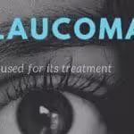 glaucoma