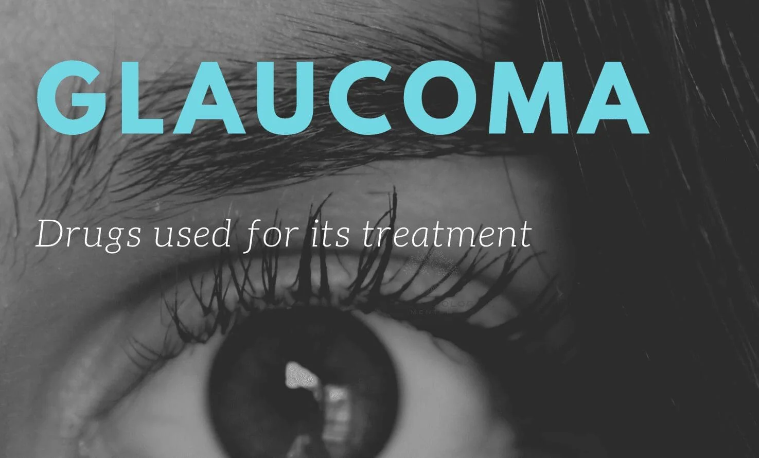 glaucoma