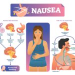 CTZ role in nausea and vomiting