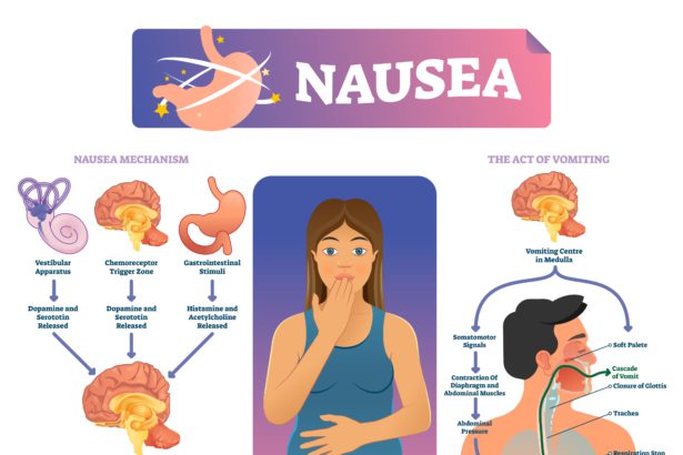 CTZ role in nausea and vomiting