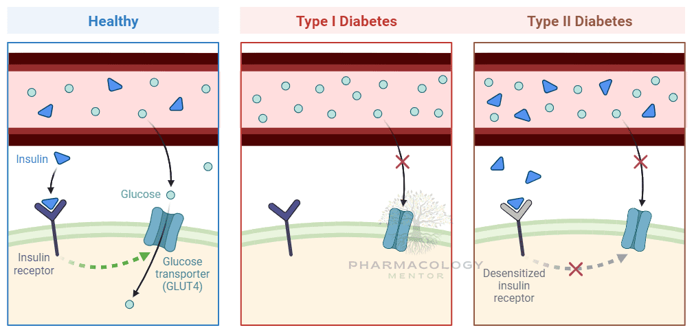 Diabetes-types-comparison