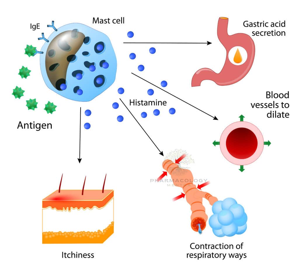 Histamine Allergies or allergic diseases