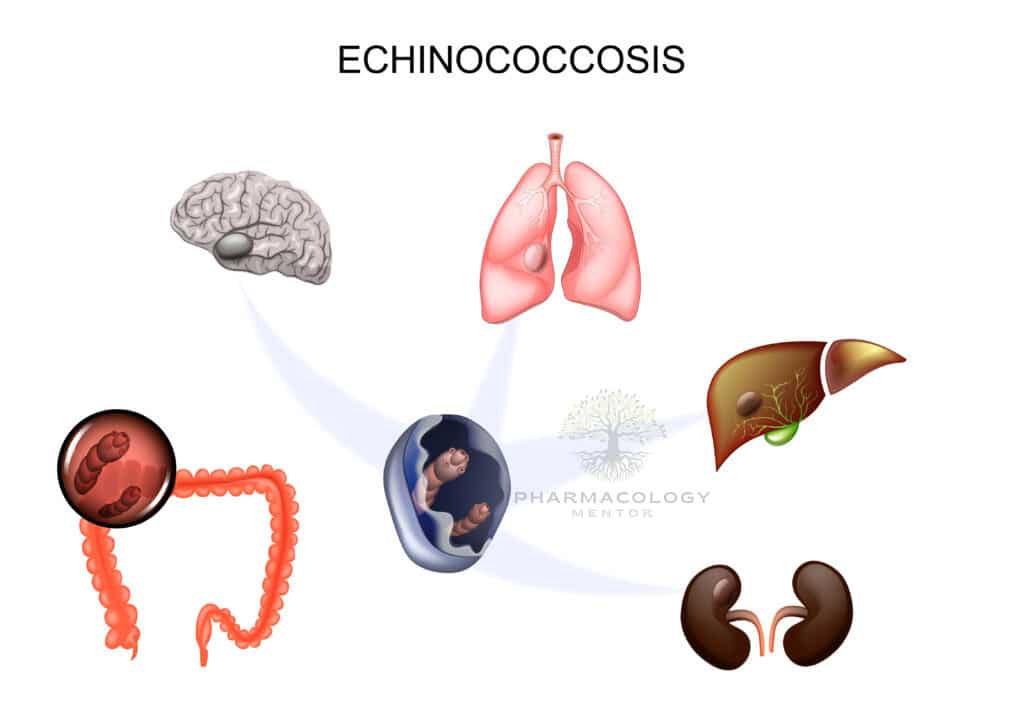 Albendazole: the causative agent Echinococcus
