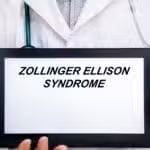 Zollinger-Ellison Syndrome