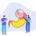 Gastroesophageal Reflux Disease