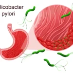 helicobacter_pylori