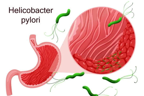 helicobacter_pylori
