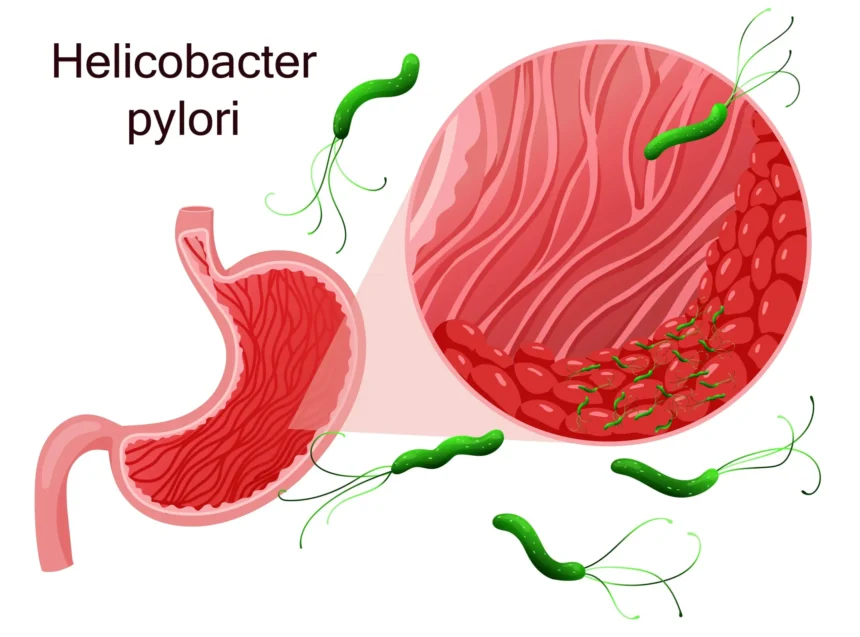 helicobacter_pylori