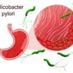 Helicobacter pylori