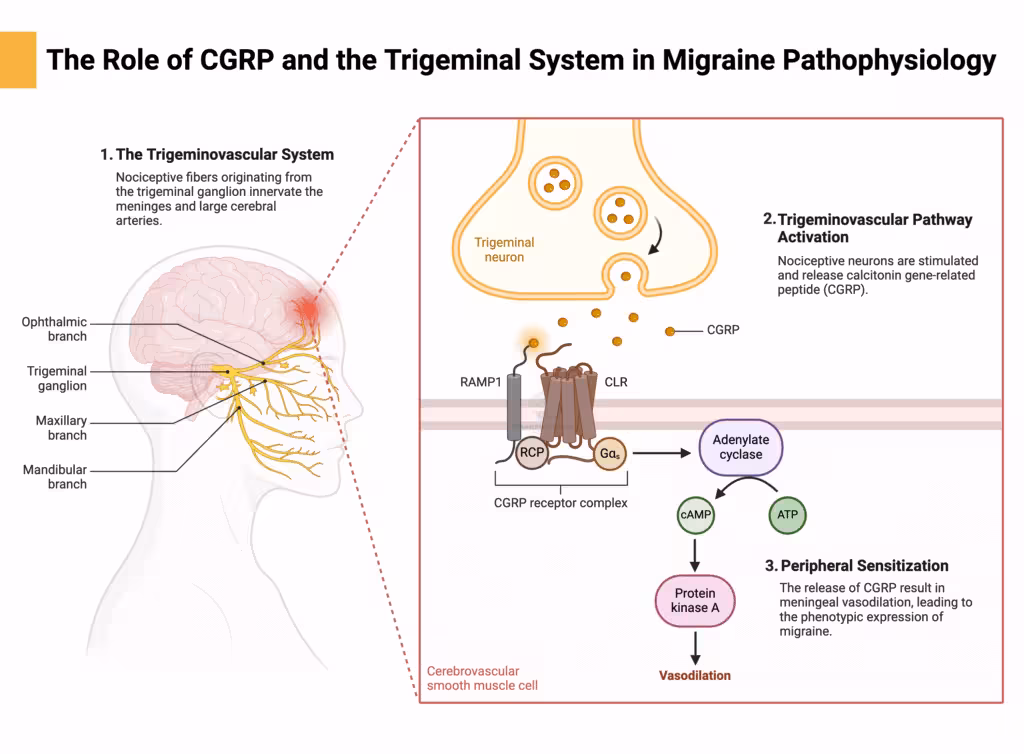 Pathophysiology of Migraine