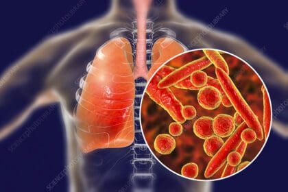 Mycoplasma pneumoniae