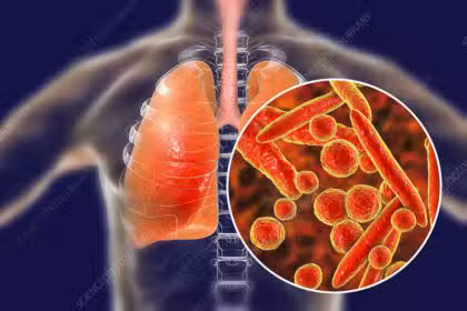 Mycoplasma pneumoniae